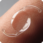 lente intra-ocular
